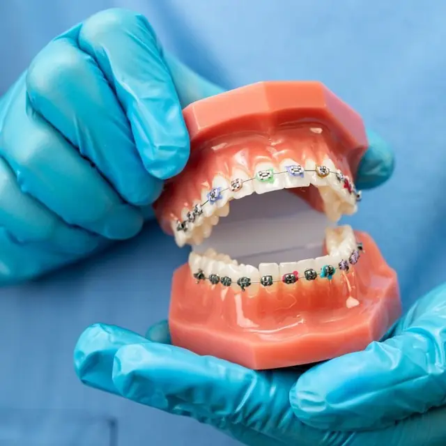 Traitement orthodontique
